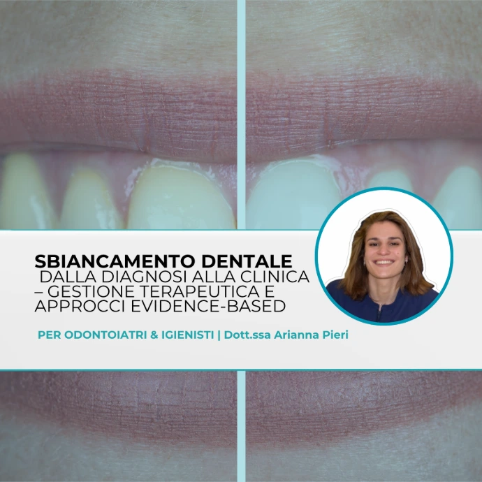 Sbiancamento Dentale: dalla diagnosi alla clinica